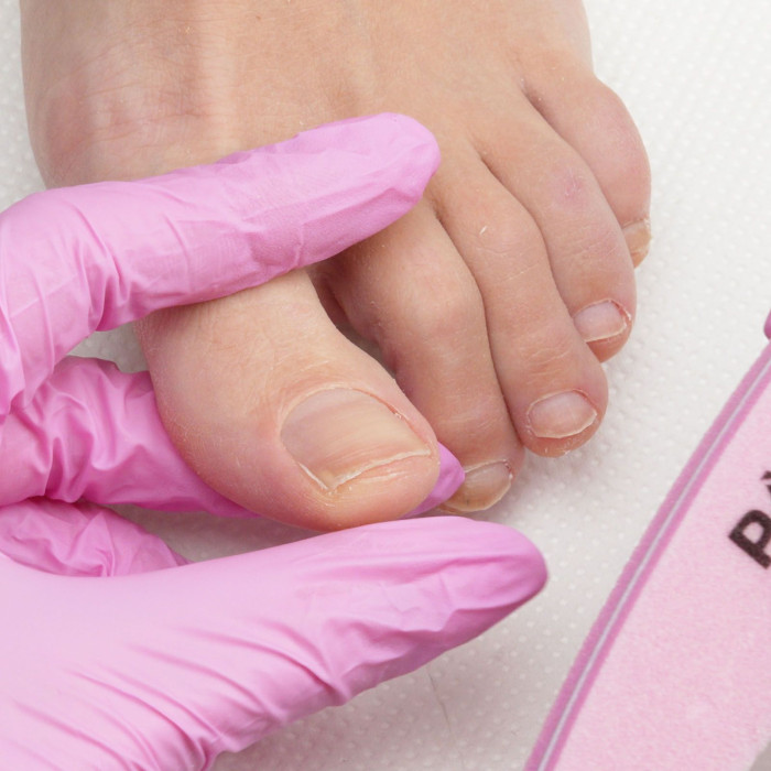 Come fare un buon pedicure curativo e ogni quanto è consigliato