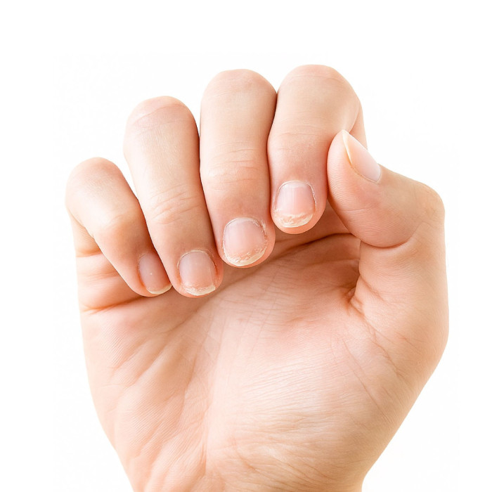 Comment soigner ses ongles abîmés :  solutions efficaces pour réparer et fortifier vos ongles