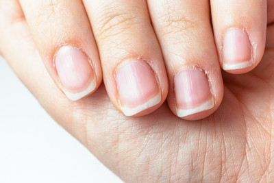 cuticole secche