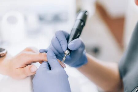 come_togliere_il_gel