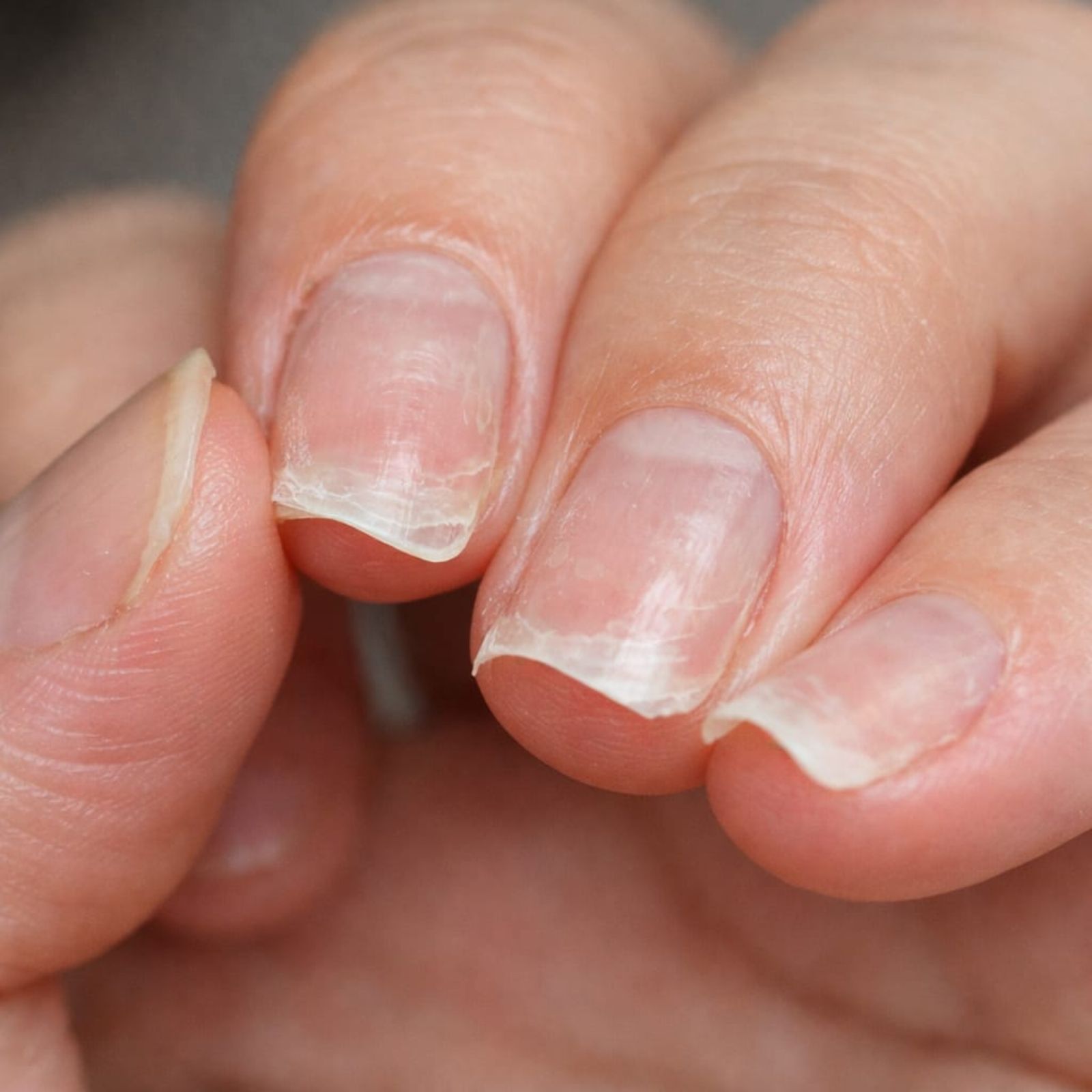 unghie molli dopo semipermanente