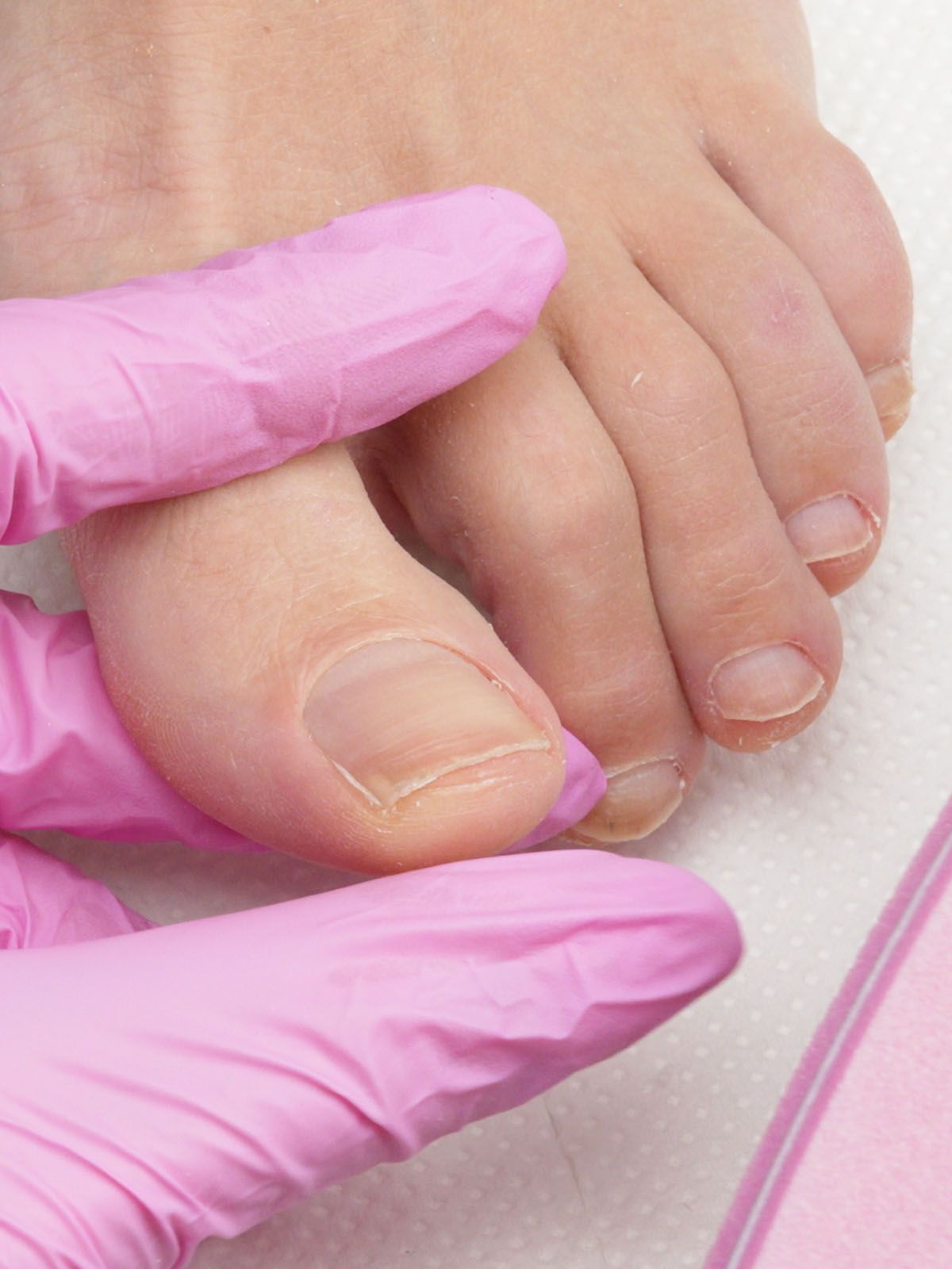 come fare pedicure curativo